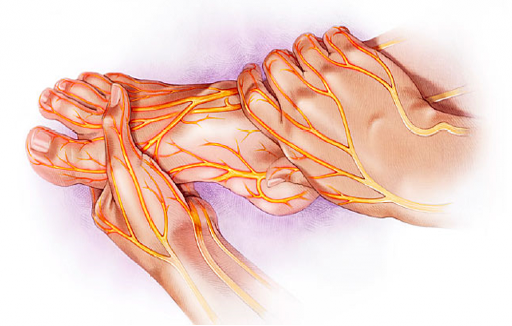 Neuropathy (1).png